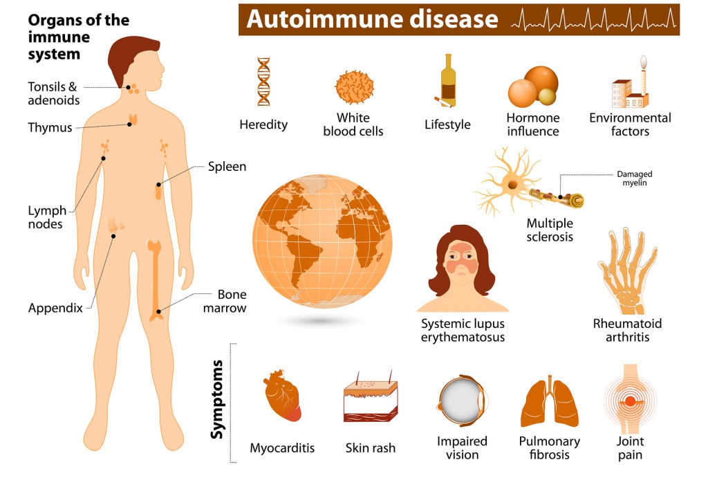 What is Vasculitis? Symptoms, Treatment & Types