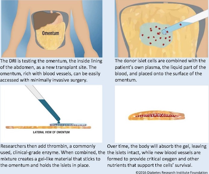 are protein scaffold organs a viable transplant option