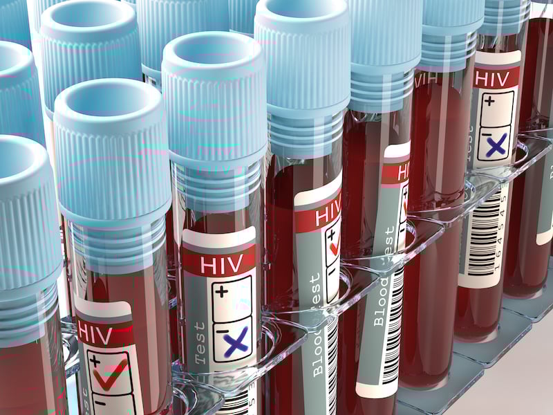 Figure 1. HIV blood tests