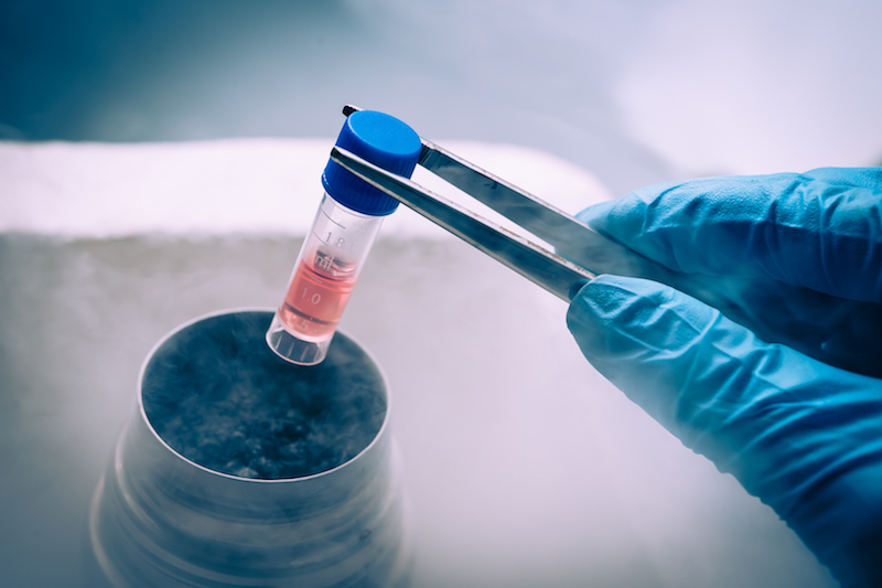 Figure 3. A stem cell suspension stored in liquid nitrogen