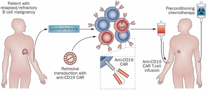 A Cure for Cancer? How CART Therapy is Revolutionizing